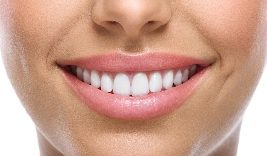 Blanchiment dentaire Dr Benichou