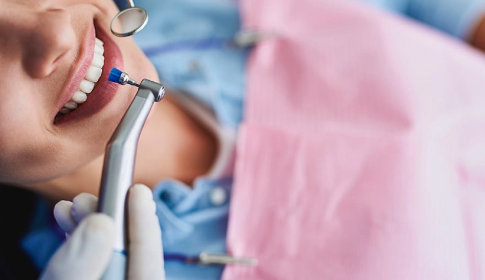 facettes esthetique docteur Benichou