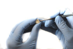 Reconstruction l'usinage maquillage Dr Benichou Toulouse