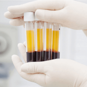 Le PRF Toulouse Dr Benichou