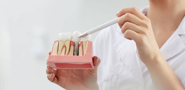 Traitements chez Dr Benichou: Soins conservateurs, les couronnes & les Inlay - Onlay, les prothèses fixes & amovibles, la parodontologie médicale, les Facettes céramiques, l’éclaircissement dentaire