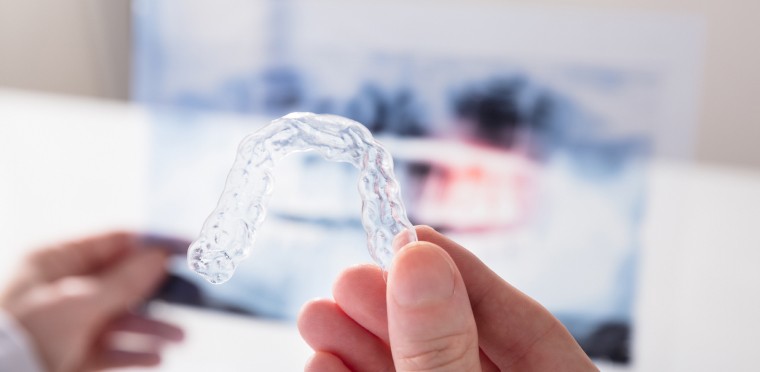 invisalign avant apres Dr Mathieu Benichou chirurgien dentiste blog Toulouse