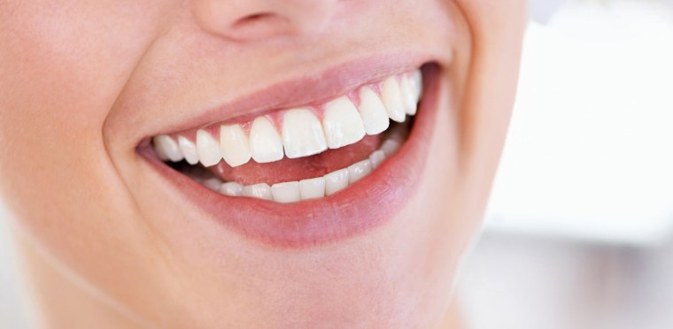 Détartrage dentaire chez le dentiste : un guide complet