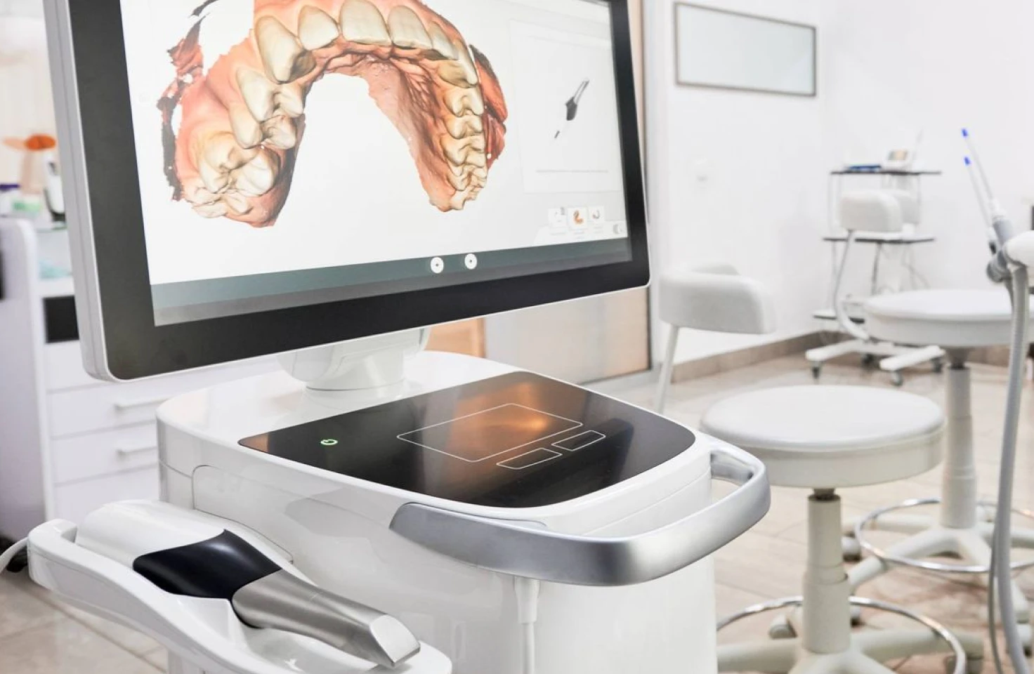 L’empreinte optique numérique 3D Itero à Toulouse