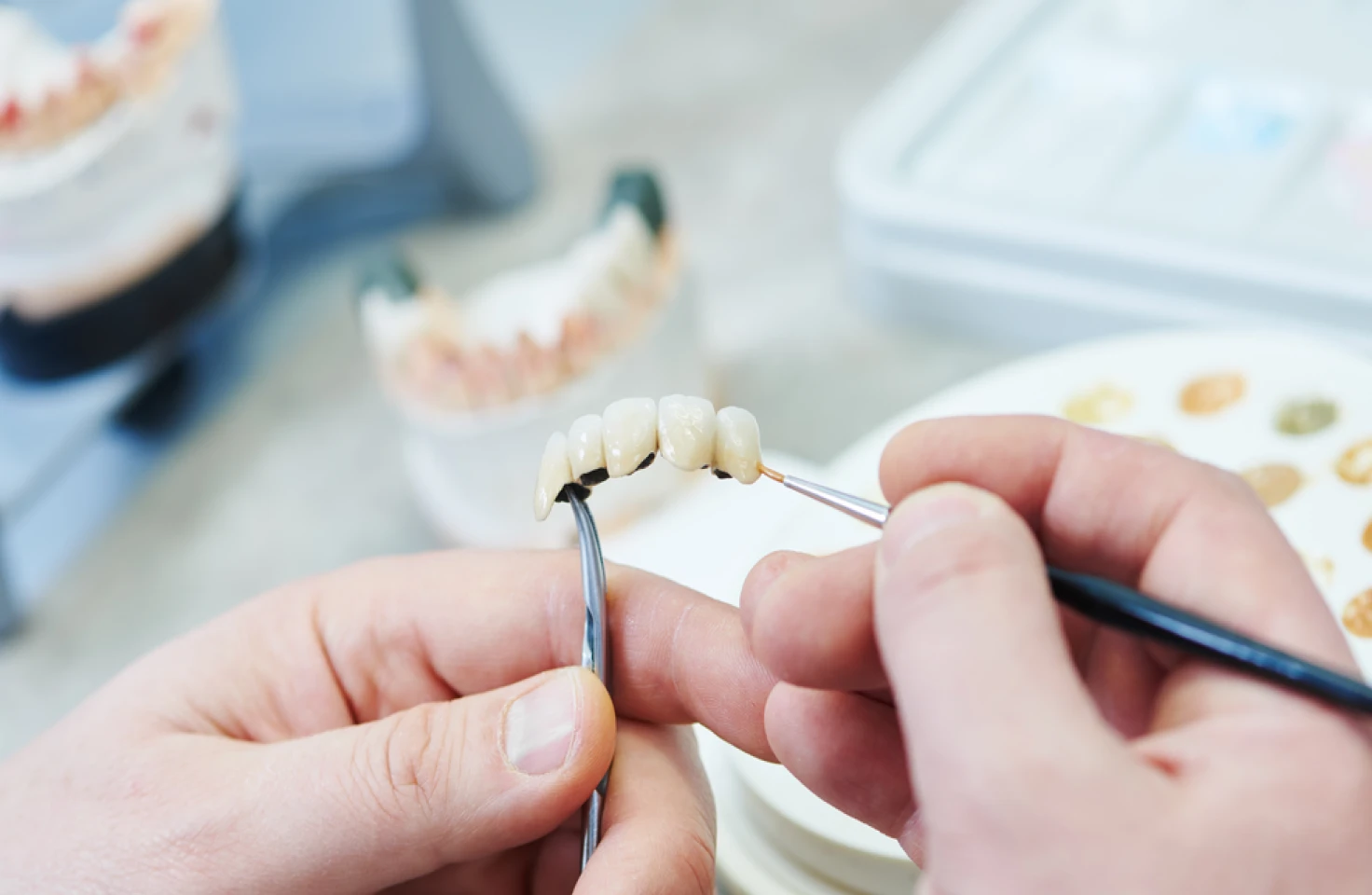 Reconstruction l'usinage, maquillage au cabinet du Dr Mathieu Benichou à Toulouse