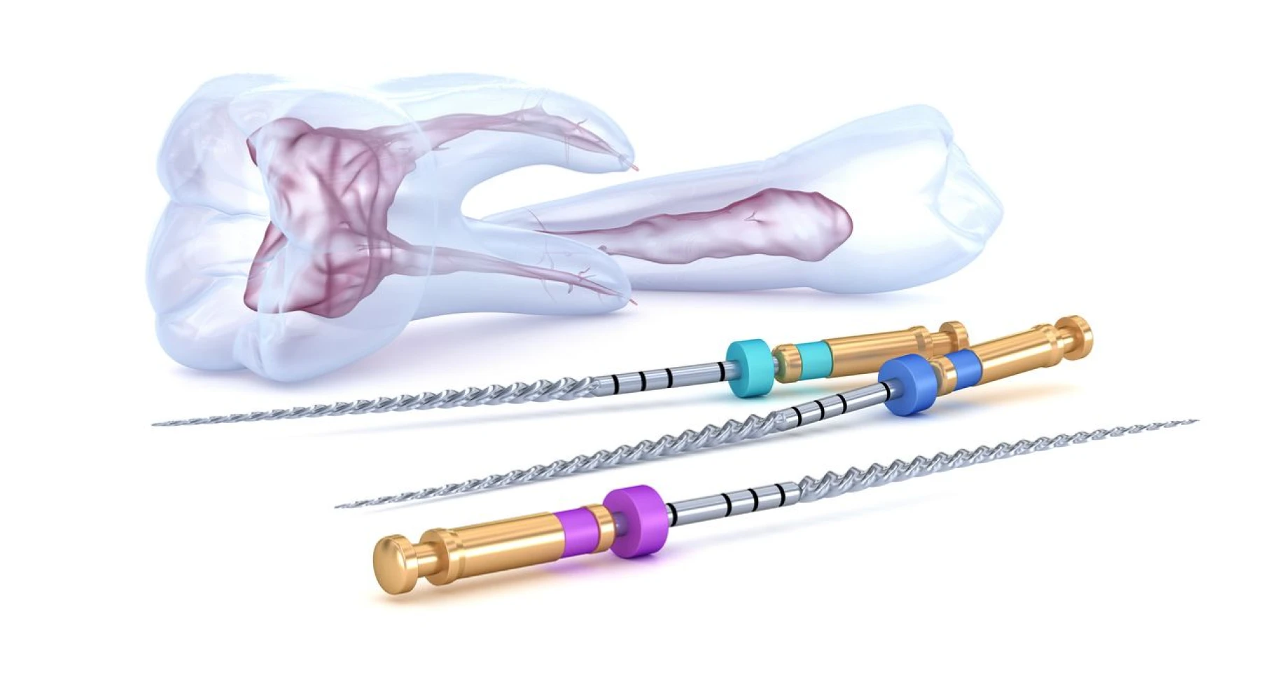 Le traitement canalaire sous digue à Toulouse