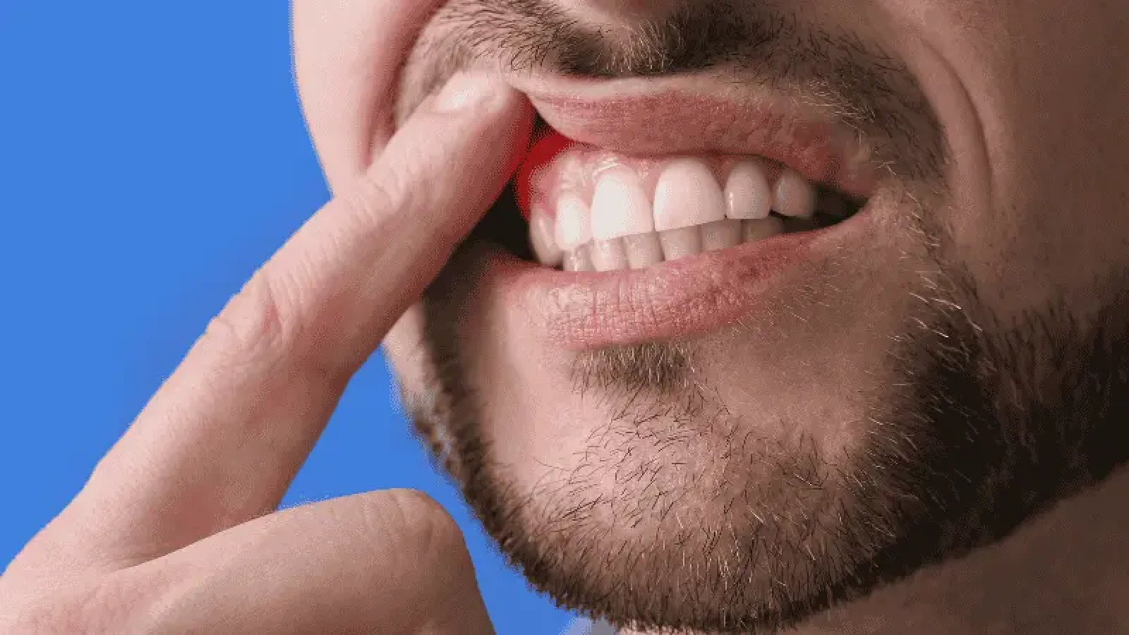Déchaussement des dents : comment l’éviter et le traiter ?